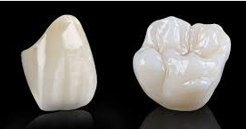 ZIRCONIA CROWN